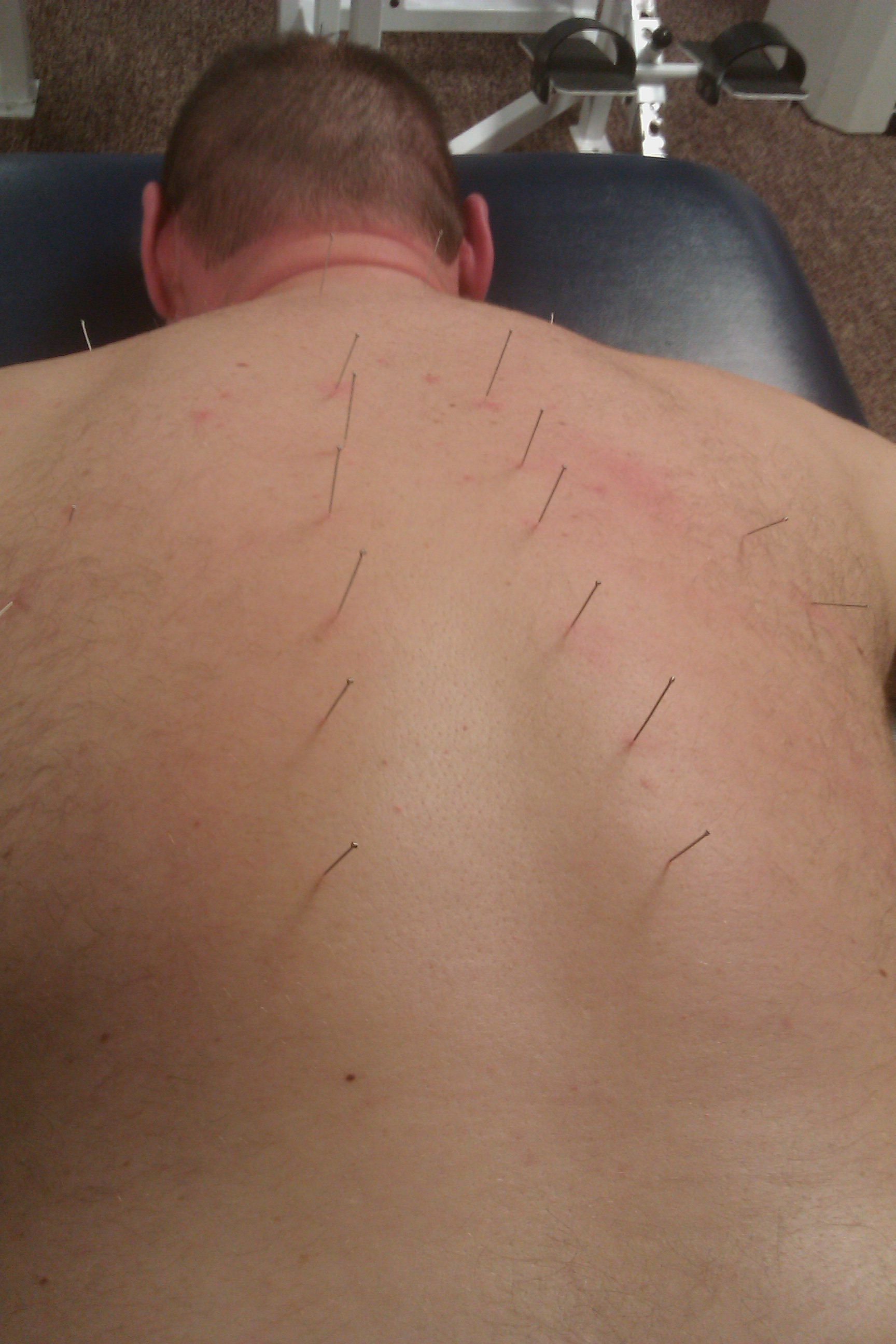 dry back
